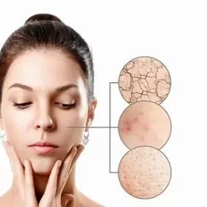 روش های تشخیص نوع پوست