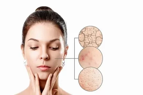 روش های تشخیص نوع پوست