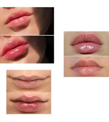 خرید اینترنتی حجم دهنده لب فوری دخترانه
