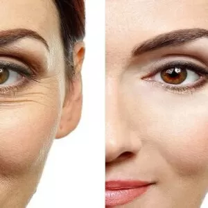 دلایل استفاده از کرم دور چشم