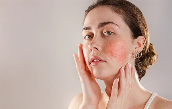 تکنیک های مراقبت از پوست حساس
