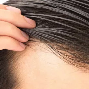 علت چرب شدن بیش از حد موها