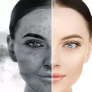تاثیر آلودگی هوا بر روی پوست و مو