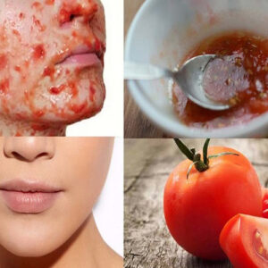 خواص ژل گوجه فرنگی روی پوست صورت