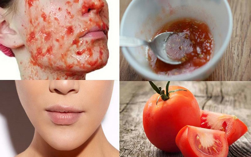 خواص ژل گوجه فرنگی روی پوست صورت