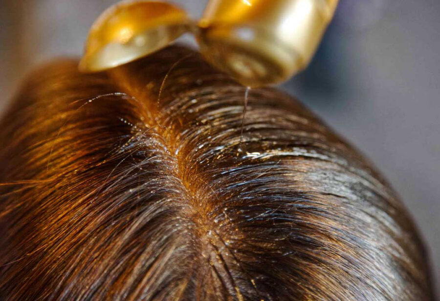 روغن تراپی مو چیست و چگونه انجام می شود