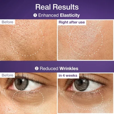 رضایت مشتری اسنس بایولیفتینگ نامبر 9 نامبوزین